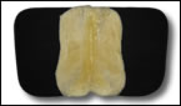 Preview: Engel SCHABRACKE 1 - Fellkranz vorne